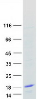 SNRPG Protein - Purified recombinant protein SNRPG was analyzed by SDS-PAGE gel and Coomassie Blue Staining