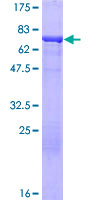 SNTA1 / Syntrophin Alpha 1 Protein - 12.5% SDS-PAGE of human SNTA1 stained with Coomassie Blue