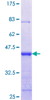 SNTA1 / Syntrophin Alpha 1 Protein - 12.5% SDS-PAGE Stained with Coomassie Blue.