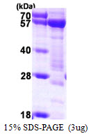 SNTA1 / Syntrophin Alpha 1 Protein