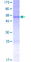 SNTB2 Protein - 12.5% SDS-PAGE of human SNTB2 stained with Coomassie Blue