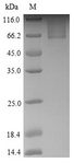 SNTG1 Protein - (Tris-Glycine gel) Discontinuous SDS-PAGE (reduced) with 5% enrichment gel and 15% separation gel.