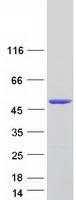 SNUPN Protein - Purified recombinant protein SNUPN was analyzed by SDS-PAGE gel and Coomassie Blue Staining