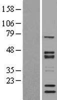 SNW1 / SKIP Protein - Western validation with an anti-DDK antibody * L: Control HEK293 lysate R: Over-expression lysate