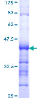SNW1 / SKIP Protein - 12.5% SDS-PAGE Stained with Coomassie Blue.