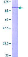 SNX1 Protein - 12.5% SDS-PAGE of human SNX1 stained with Coomassie Blue