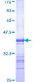 SNX1 Protein - 12.5% SDS-PAGE Stained with Coomassie Blue.