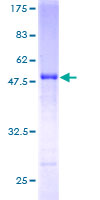 SNX10 Protein - 12.5% SDS-PAGE of human SNX10 stained with Coomassie Blue
