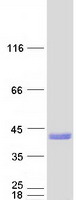 SNX11 Protein - Purified recombinant protein SNX11 was analyzed by SDS-PAGE gel and Coomassie Blue Staining