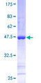 SNX12 Protein - 12.5% SDS-PAGE of human SNX12 stained with Coomassie Blue