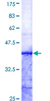 SNX12 Protein - 12.5% SDS-PAGE Stained with Coomassie Blue