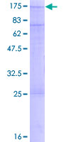 SNX13 Protein - 12.5% SDS-PAGE of human SNX13 stained with Coomassie Blue