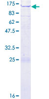 SNX14 Protein - 12.5% SDS-PAGE of human SNX14 stained with Coomassie Blue