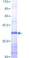 SNX14 Protein - 12.5% SDS-PAGE Stained with Coomassie Blue.
