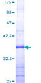 SNX14 Protein - 12.5% SDS-PAGE Stained with Coomassie Blue.