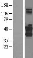 SNX16 Protein - Western validation with an anti-DDK antibody * L: Control HEK293 lysate R: Over-expression lysate