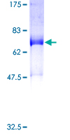 SNX16 Protein - 12.5% SDS-PAGE of human SNX16 stained with Coomassie Blue