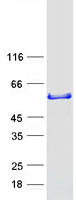 SNX16 Protein - Purified recombinant protein SNX16 was analyzed by SDS-PAGE gel and Coomassie Blue Staining