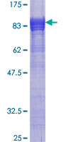 SNX17 Protein - 12.5% SDS-PAGE of human SNX17 stained with Coomassie Blue
