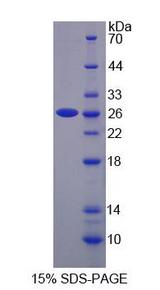 SNX17 Protein - Recombinant Sorting Nexin 17 By SDS-PAGE