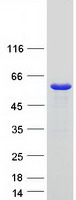SNX17 Protein - Purified recombinant protein SNX17 was analyzed by SDS-PAGE gel and Coomassie Blue Staining