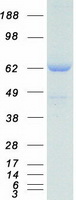 SNX2 Protein - Purified recombinant protein SNX2 was analyzed by SDS-PAGE gel and Coomassie Blue Staining