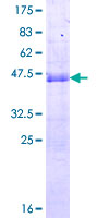 SNX20 Protein - 12.5% SDS-PAGE of human SLIC1 stained with Coomassie Blue