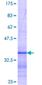 SNX20 Protein - 12.5% SDS-PAGE Stained with Coomassie Blue.