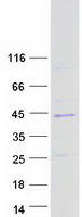 SNX20 Protein - Purified recombinant protein SNX20 was analyzed by SDS-PAGE gel and Coomassie Blue Staining