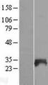 SNX21 Protein - Western validation with an anti-DDK antibody * L: Control HEK293 lysate R: Over-expression lysate