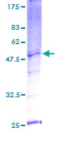SNX21 Protein - 12.5% SDS-PAGE of human SNX21 stained with Coomassie Blue