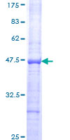 SNX22 Protein - 12.5% SDS-PAGE Stained with Coomassie Blue.
