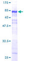 SNX25 Protein - 12.5% SDS-PAGE of human SNX25 stained with Coomassie Blue