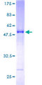 SNX27 Protein - 12.5% SDS-PAGE of human SNX27 stained with Coomassie Blue