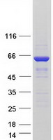 SNX27 Protein - Purified recombinant protein SNX27 was analyzed by SDS-PAGE gel and Coomassie Blue Staining