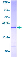 SNX3 Protein - 12.5% SDS-PAGE of human SNX3 stained with Coomassie Blue
