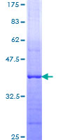 SNX31 Protein - 12.5% SDS-PAGE Stained with Coomassie Blue.