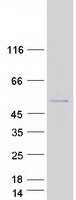 SNX31 Protein - Purified recombinant protein SNX31 was analyzed by SDS-PAGE gel and Coomassie Blue Staining