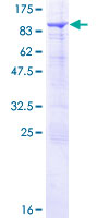 SNX33 Protein - 12.5% SDS-PAGE of human SH3PX3 stained with Coomassie Blue