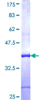 SNX33 Protein - 12.5% SDS-PAGE Stained with Coomassie Blue.