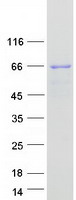 SNX33 Protein - Purified recombinant protein SNX33 was analyzed by SDS-PAGE gel and Coomassie Blue Staining