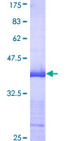 SNX4 Protein - 12.5% SDS-PAGE Stained with Coomassie Blue.