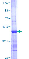 SNX7 Protein - 12.5% SDS-PAGE Stained with Coomassie Blue.