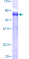 SNX8 Protein - 12.5% SDS-PAGE of human SNX8 stained with Coomassie Blue