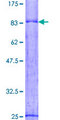 SNX8 Protein - 12.5% SDS-PAGE of human SNX8 stained with Coomassie Blue