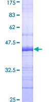 SNX8 Protein - 12.5% SDS-PAGE Stained with Coomassie Blue.