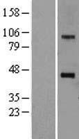SOAT1 Protein - Western validation with an anti-DDK antibody * L: Control HEK293 lysate R: Over-expression lysate