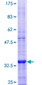 SOAT1 Protein - 12.5% SDS-PAGE Stained with Coomassie Blue.