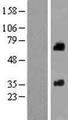 SOAT2 Protein - Western validation with an anti-DDK antibody * L: Control HEK293 lysate R: Over-expression lysate
