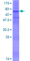 SOAT2 Protein - 12.5% SDS-PAGE of human SOAT2 stained with Coomassie Blue